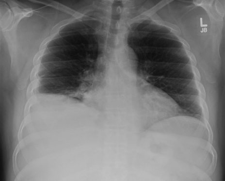 Screen Shot 2017-04-27 at 12.17.59 PM