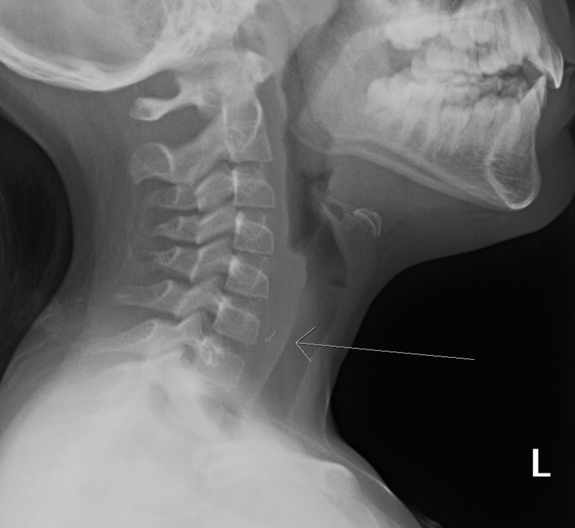 Screen Shot 2018-09-06 at 3.15.25 PM